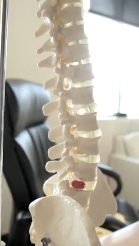 MARK (DPT) EXPLAINS WHY BACKJOY ALIGNS WITH PHYSICAL THERAPY